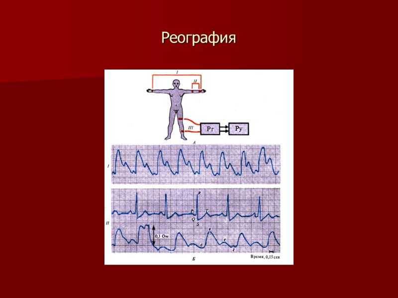 Реография